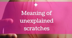 Unexplained scratches